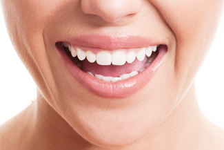 dental-veneers-benefits